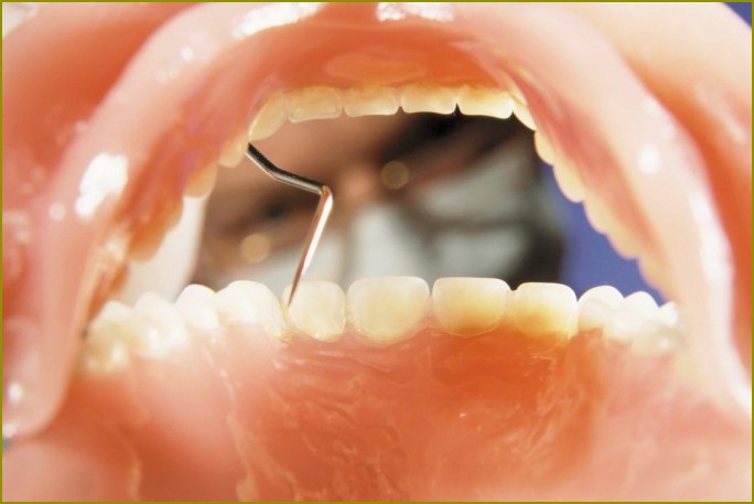 Jak wyprostować zęby